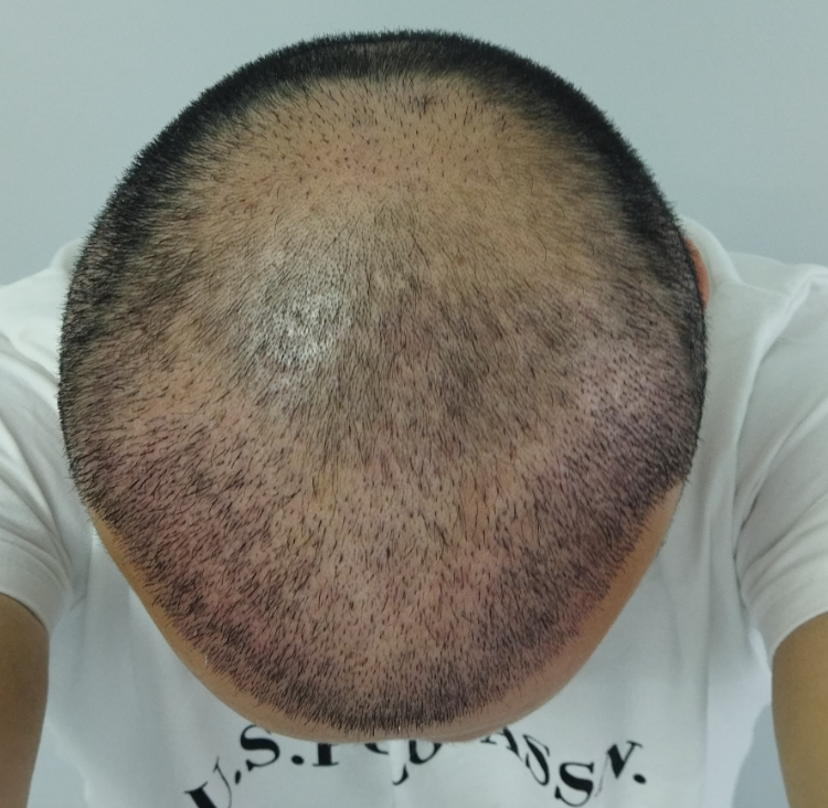 11. gün.png