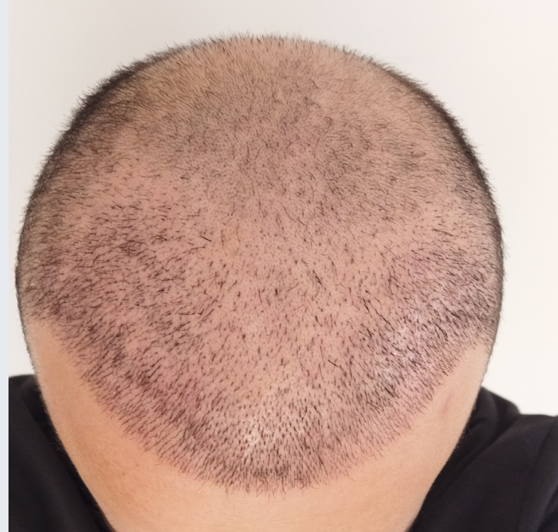 12.gün.png