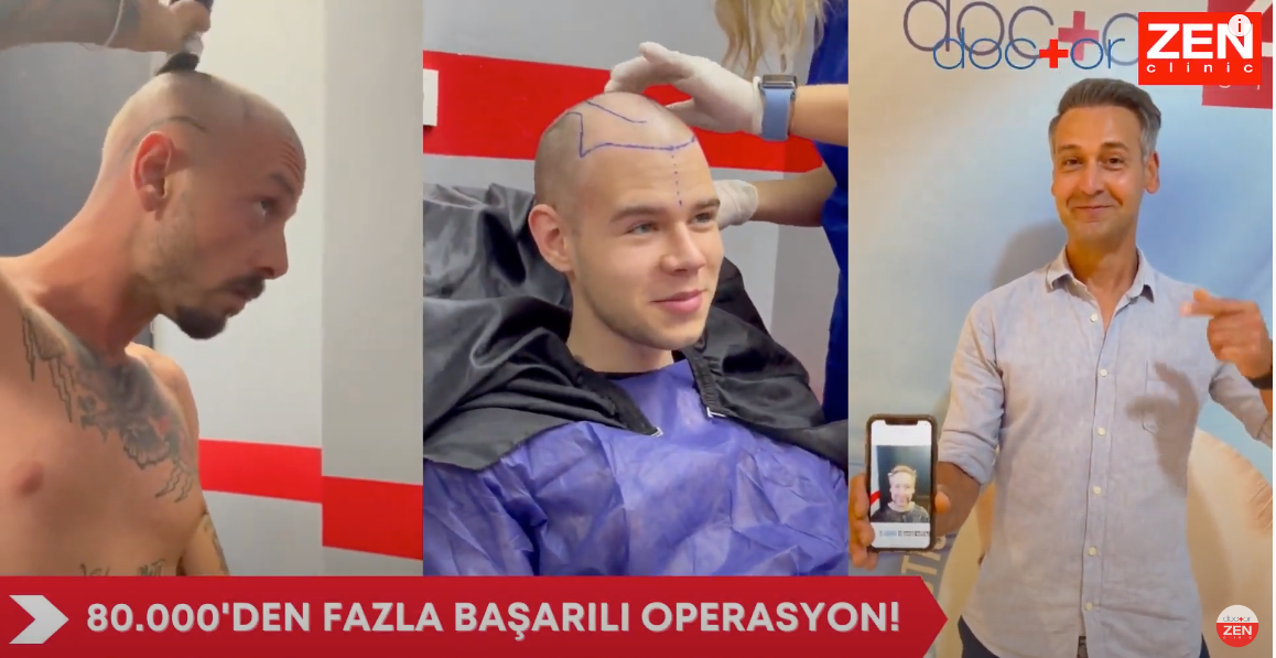 doktor zen saç ekimi.png