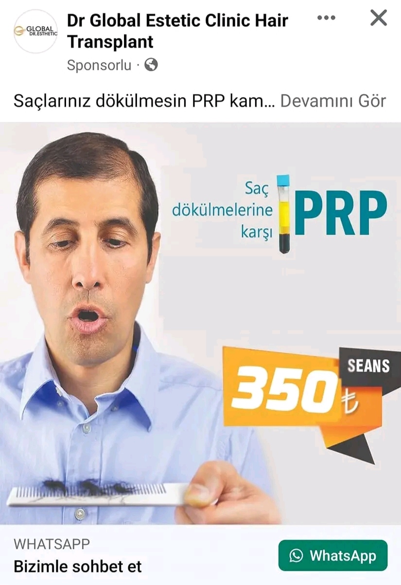 Dr. Global Estetic Clinic Hair Transplant PRP yaptıranlar.jpg