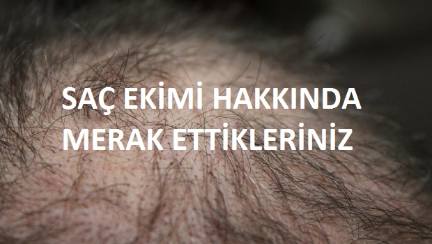 Ekilen Saçların Tuttuğu Nasıl Anlaşılır.jpg