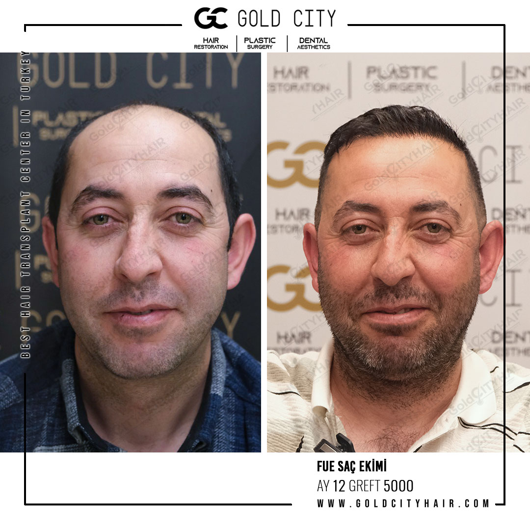 goldcityhair.jpeg