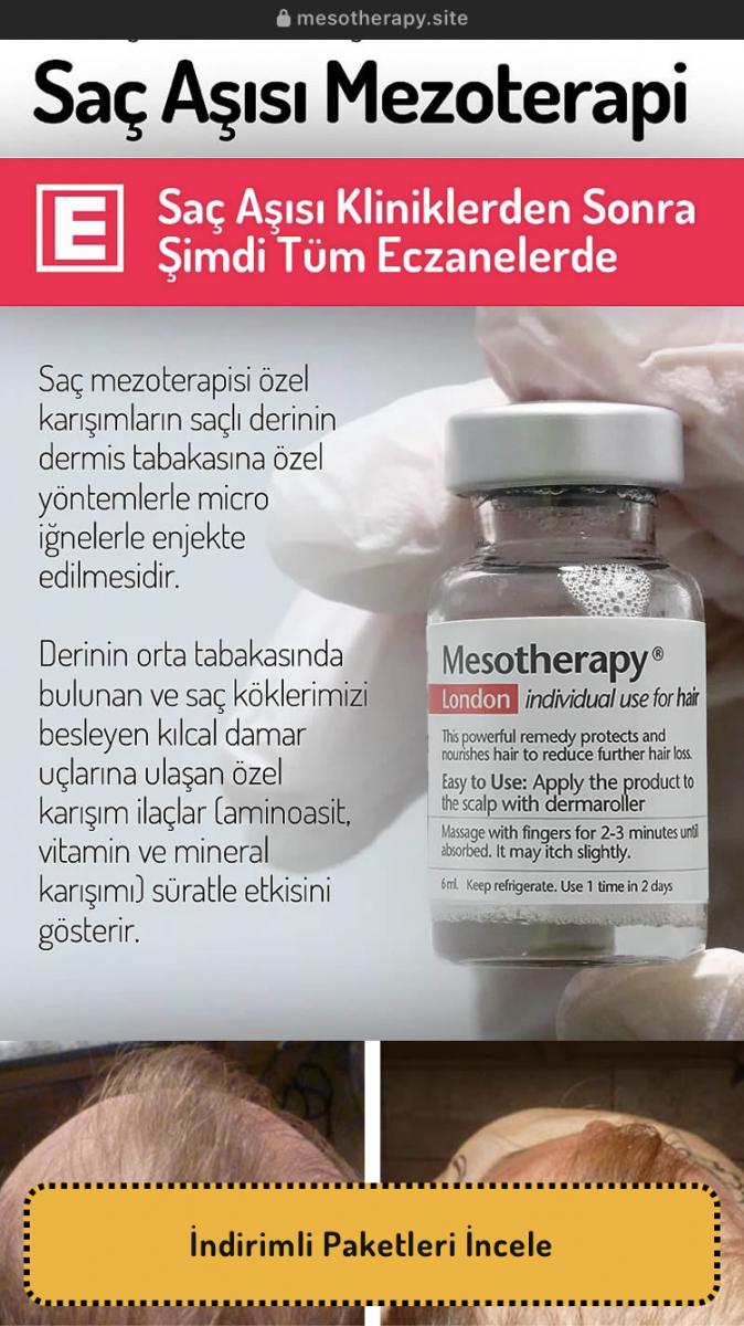 Mesotherapy Saç Aşısı kullananlar.jpg
