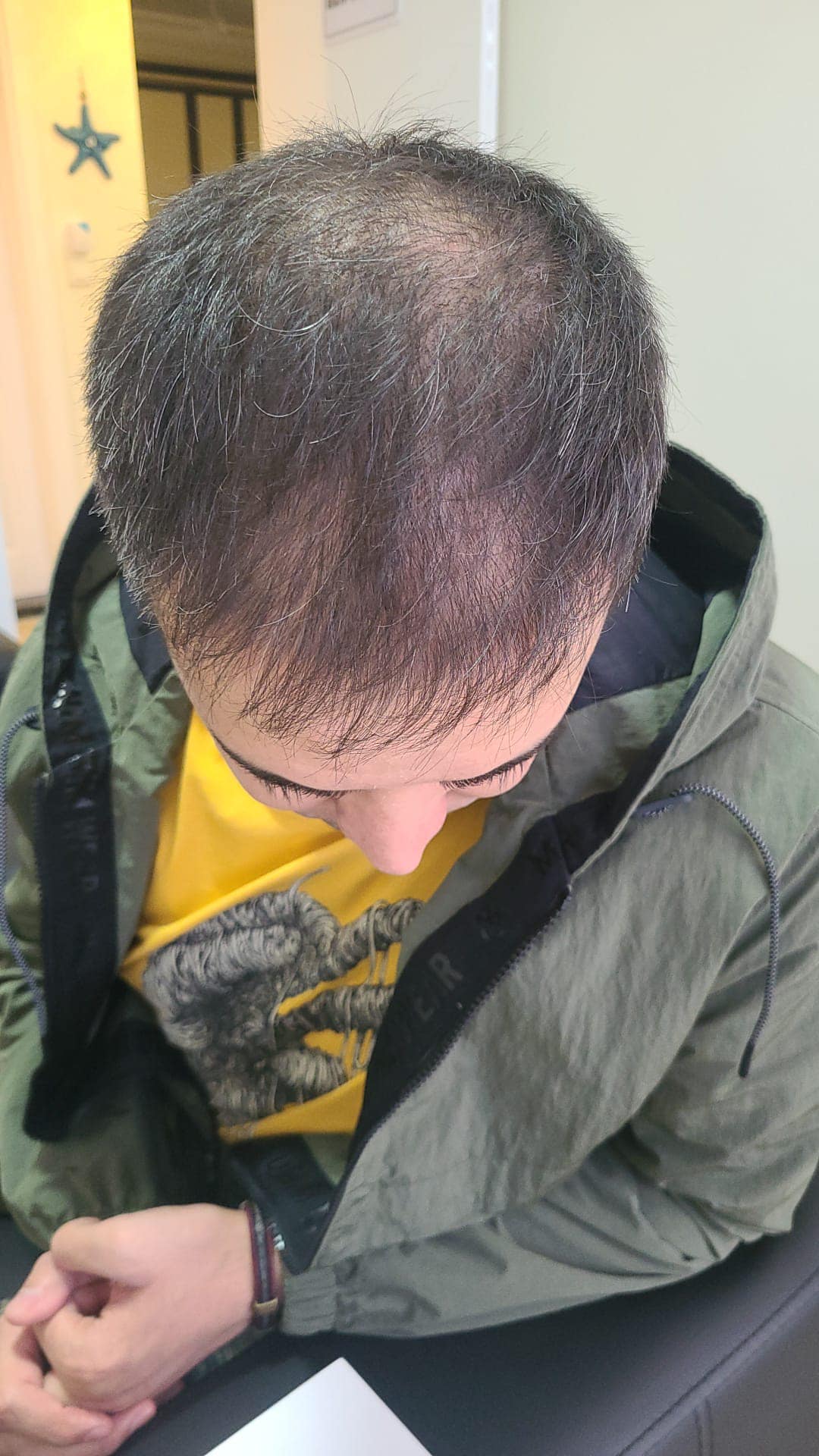 ossi hair.jpeg