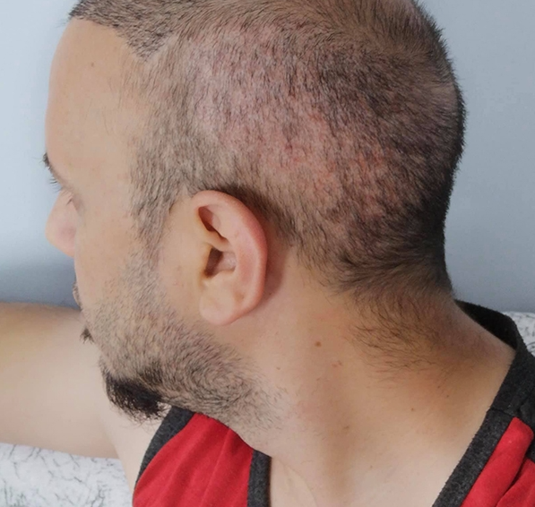serkan aydın donör sol.png