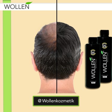 Wollen Saç Dolgunlaştırıcı Kullananlar Yorumları